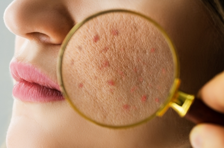 DR YV SKIN, HAIR & LASER CLINIC